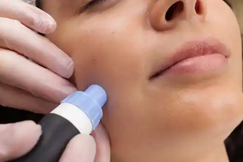 apparative-kosmetik-mit-sicherheits-nachweis Sichere apparative Kosmetik – NiSV/APV-Fachkunde